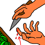I cut my finger.